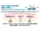 トヨタアップグレードセレクション対象車両になります。